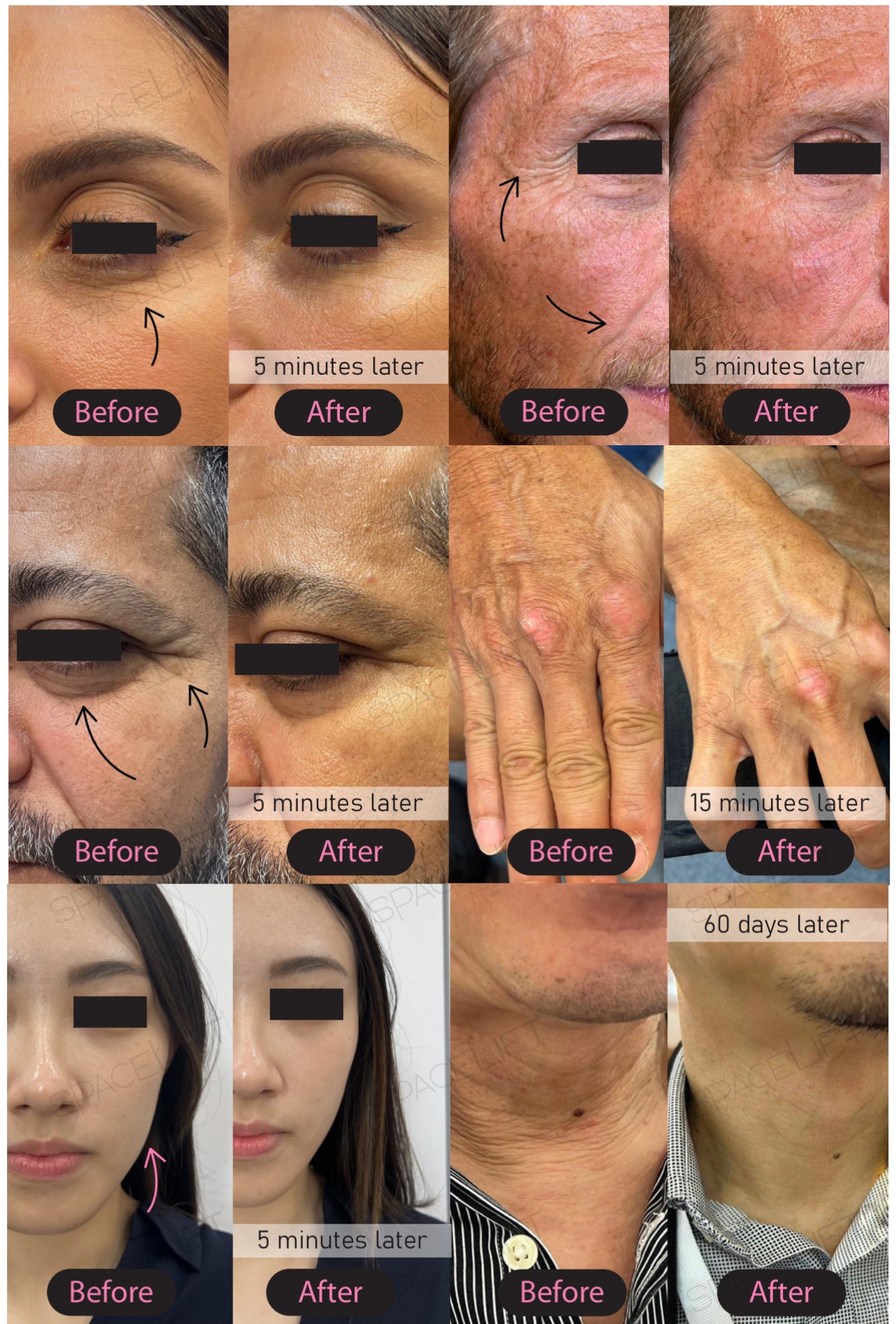 Kynningarverð| Forsala! Lendir vonandi 19. Des | SPACELIFT | 100 ml