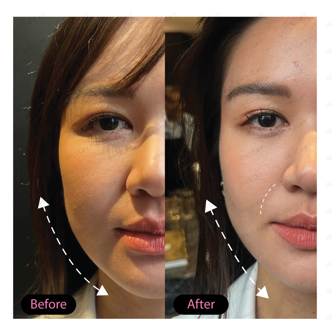 Kynningarverð | Forsala! Lendir vonandi 19-22. Des| SPACELIFT | 30 ml