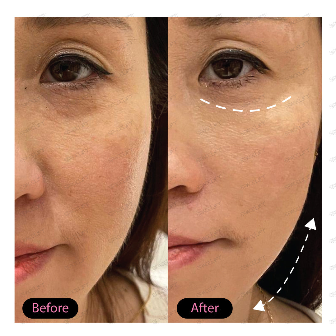 Kynningarverð | Forsala! Lendir vonandi 19-22. Des| SPACELIFT | 30 ml